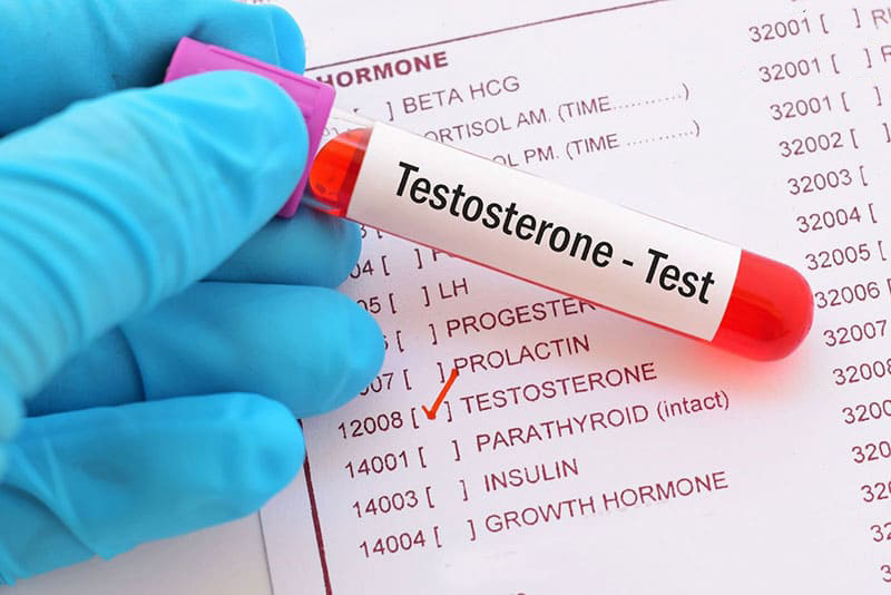 xét nghiệm testosterone khi có các dấu hiệu về sức khỏe, suy giảm khả năng tình dục xét nghiệm testosterone khi có các dấu hiệu về sức khỏe, suy giảm khả năng tình dục