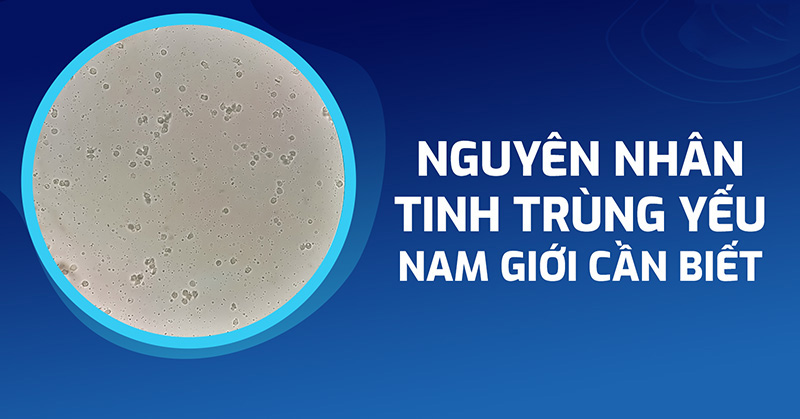 nguyên nhân tinh trùng yếu