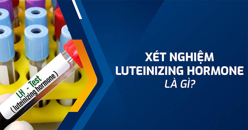 xét nghiệm luteinizing hormone là gì? xét nghiệm luteinizing hormone là gì?