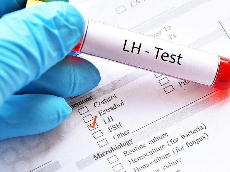 xét nghiệm chỉ số lh được thực hiện bằng cách lấy và phân tích mẫu máu xét nghiệm chỉ số lh được thực hiện bằng cách lấy và phân tích mẫu máu