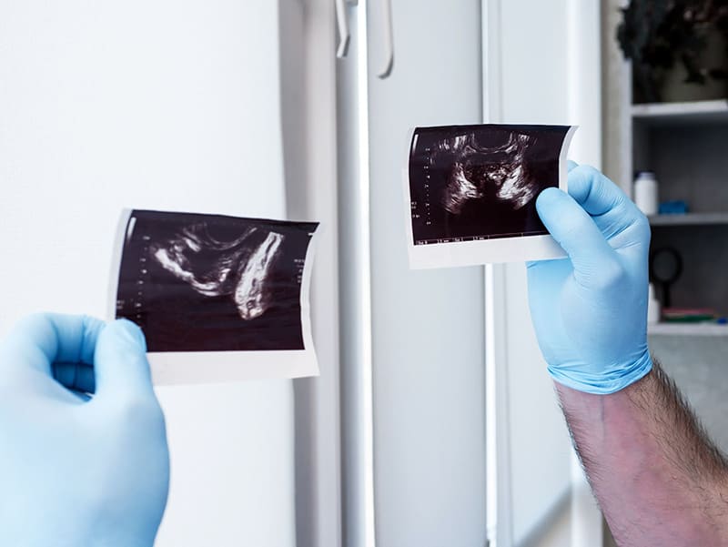 chẩn đoán, đánh giá tình trạng liệt dương