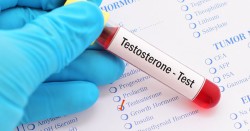 Tổng quan về chứng rối loạn nội tiết tố nam Testosterone