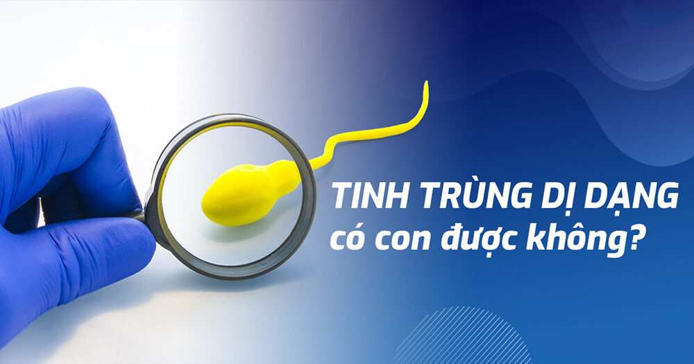 Tinh trùng dị dạng có mang thai được không? Có con ra sao?