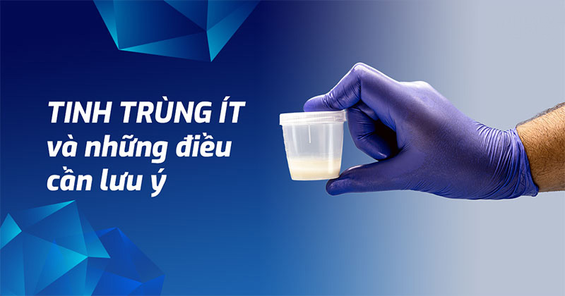 Tinh trùng ít: Nguyên nhân, dấu hiệu và cách phòng ngừa