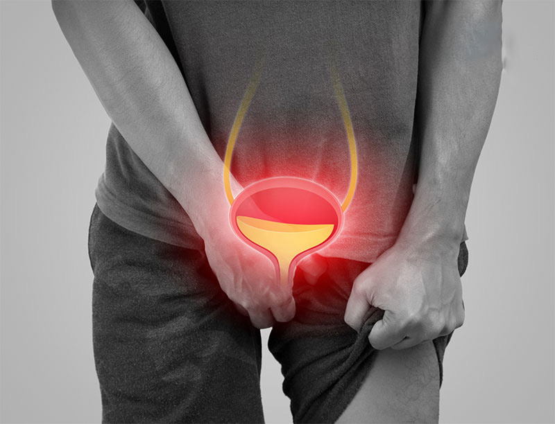 một số dấu hiệu bất thường ở bộ phận sinh dục bẩm sinh khiến nguy cơ xuất tinh ngược tăng cao.