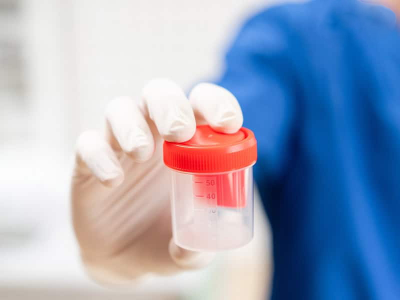 bác sĩ sẽ tiến hành một số xét nghiệm nhằm xác định mức độ hóa lỏng của tinh dịch