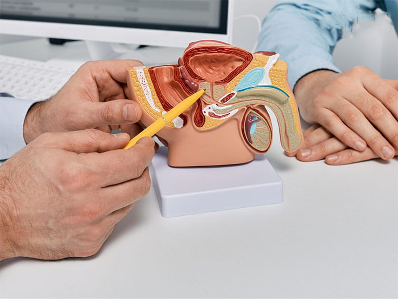 Xuất tinh bị đau rát có thể là một dấu hiệu của ung thư tuyến tiền liệt