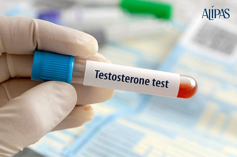 Xét nghiệm máu để kiếm tra hormone sinh dục nam