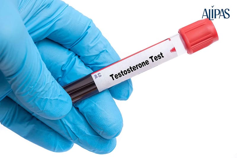 xét nghiệm testosterone