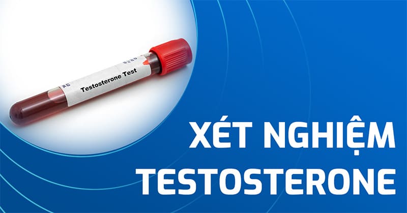 xét nghiệm testosterone
