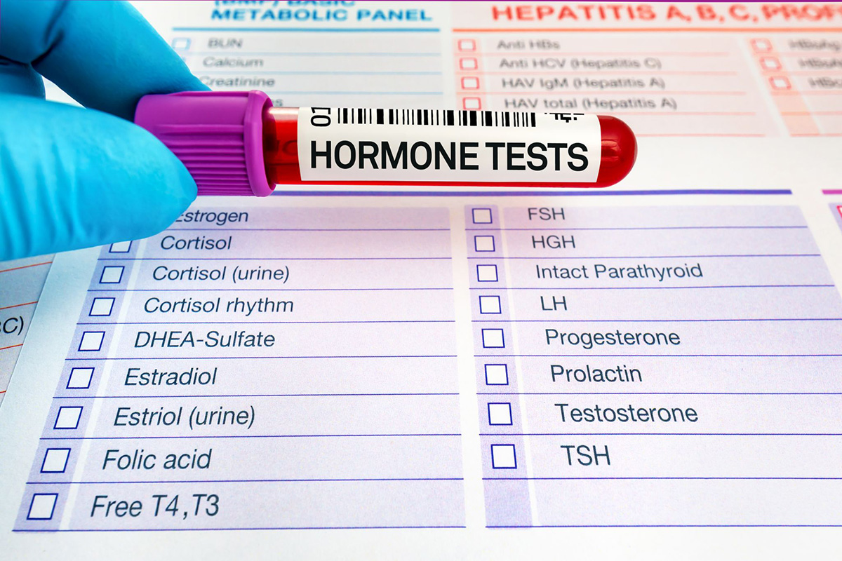 nồng độ testosterone khác nhau ở độ tuổi và giới tính