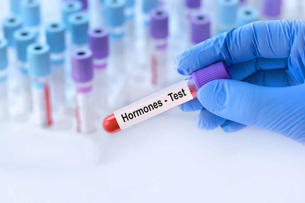 xét nghiệm định lượng hormone